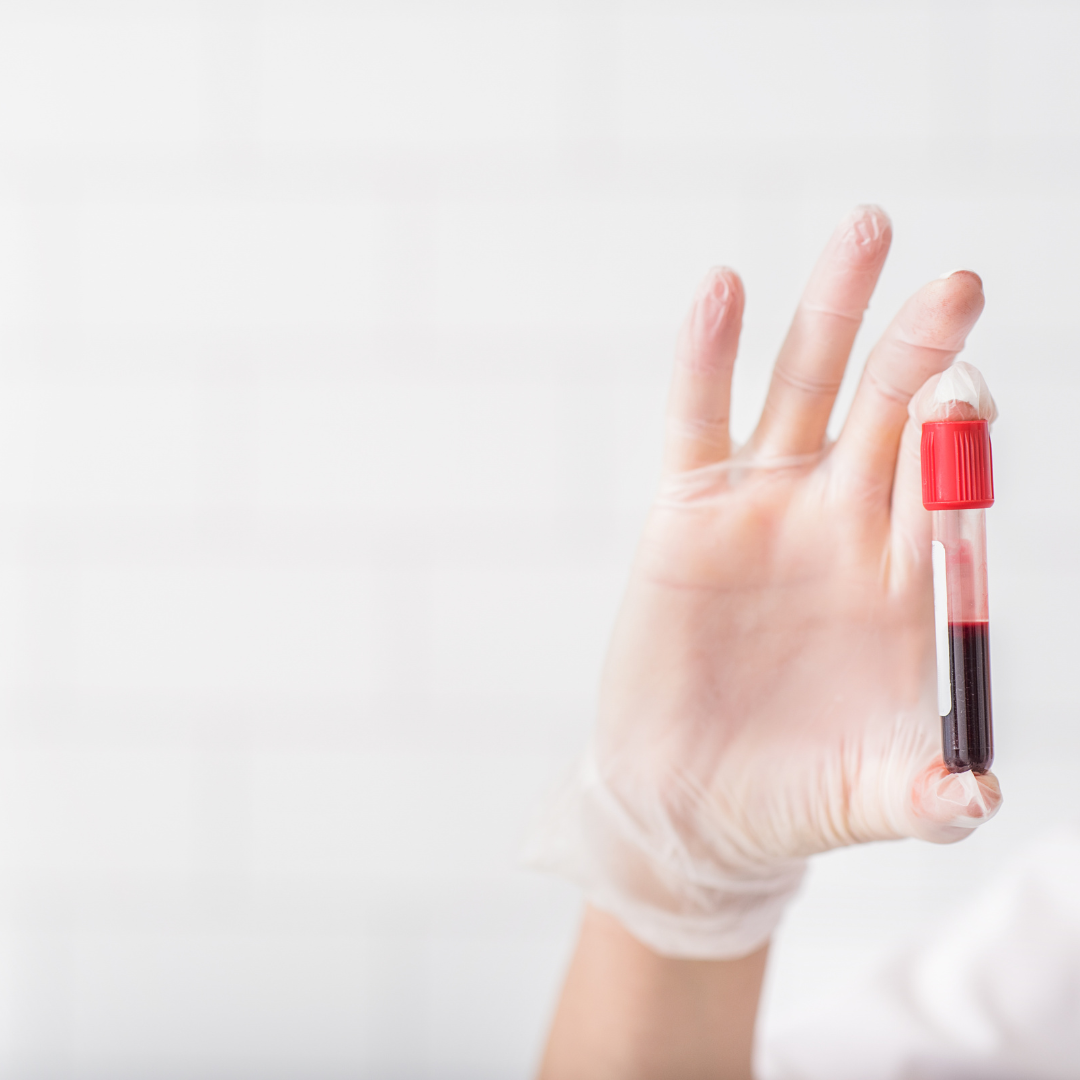Esami del sangue
